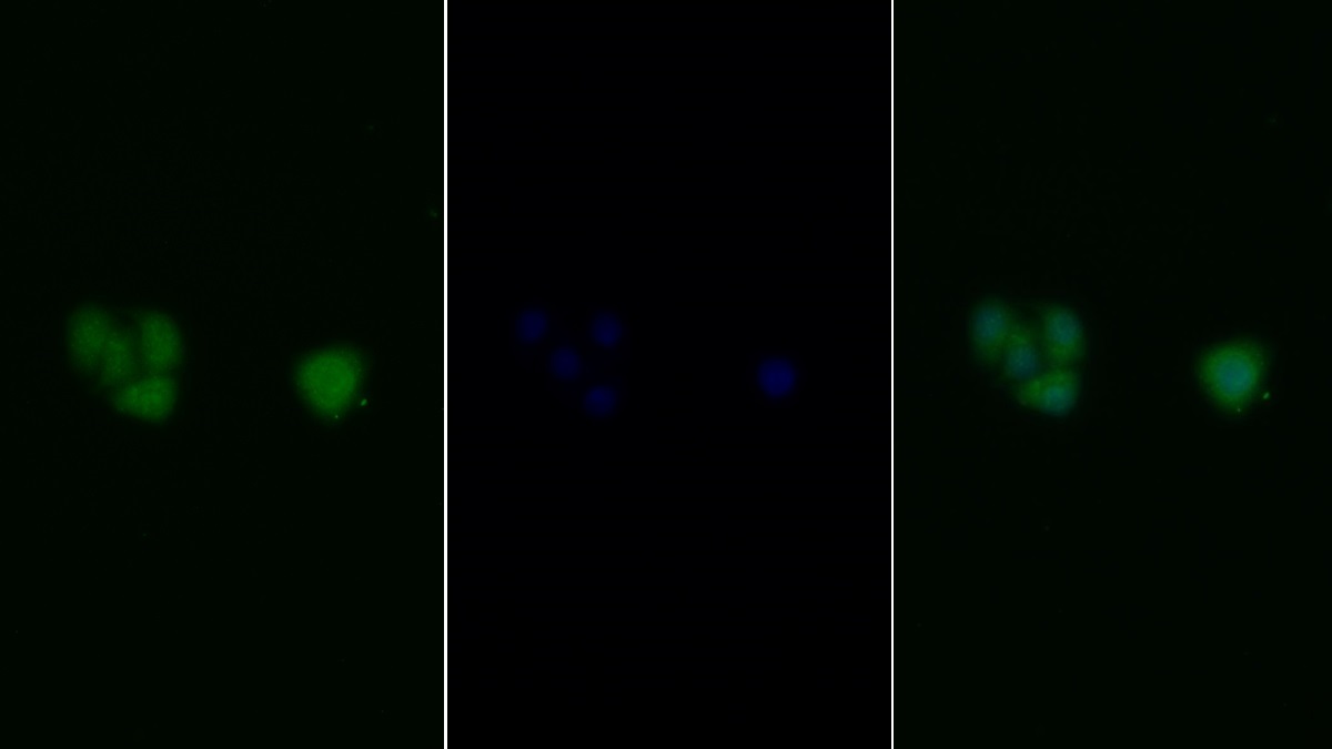 Polyclonal Antibody to c-Jun N-terminal Kinase 1 (JNK1)