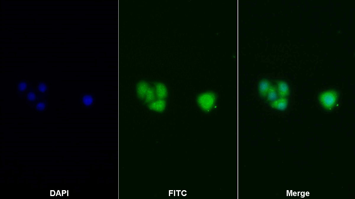 Polyclonal Antibody to c-Jun N-terminal Kinase 1 (JNK1)