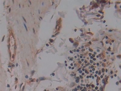 Polyclonal Antibody to Nucleoporin 155 (NUP155)