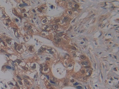 Polyclonal Antibody to Nucleoporin 155 (NUP155)