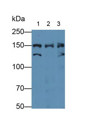 Polyclonal Antibody to Nucleoporin 155 (NUP155)