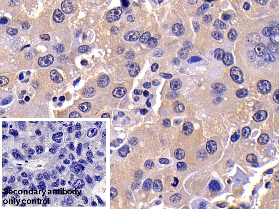 Polyclonal Antibody to Caspase 10 (CASP10)