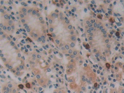 Polyclonal Antibody to Dynamin 2 (DNM2)