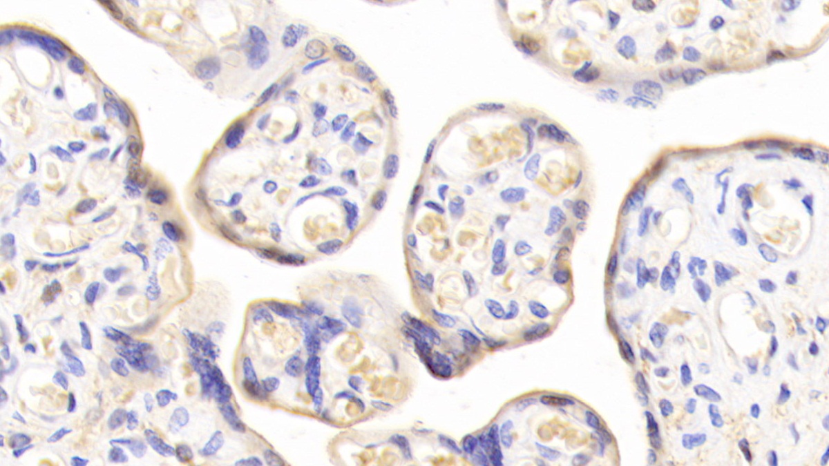 Polyclonal Antibody to Transferrin Receptor (TFR)