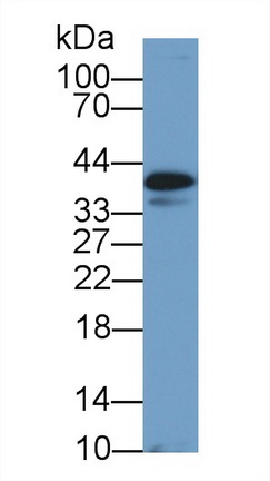 Polyclonal Antibody to Clusterin (CLU)