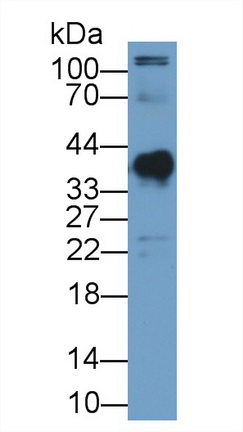 Polyclonal Antibody to Clusterin (CLU)