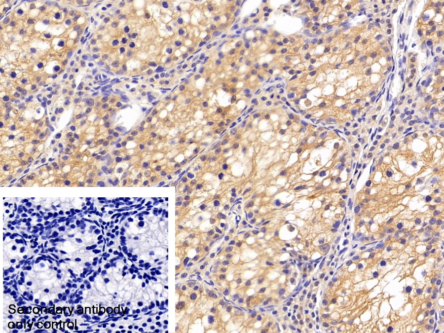 Polyclonal Antibody to Clusterin (CLU)