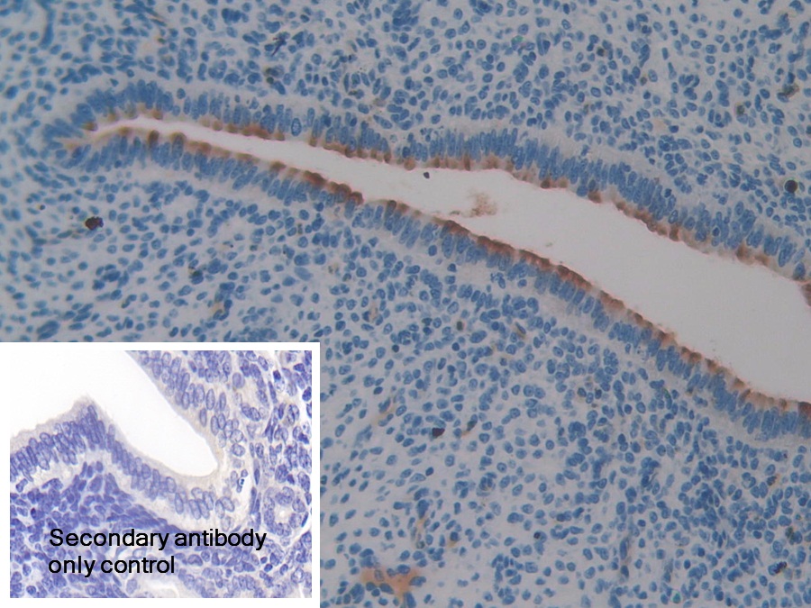 Polyclonal Antibody to Clusterin (CLU)