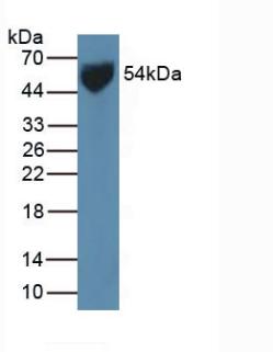 Polyclonal Antibody to Glucose Transporter 1 (GLUT1)