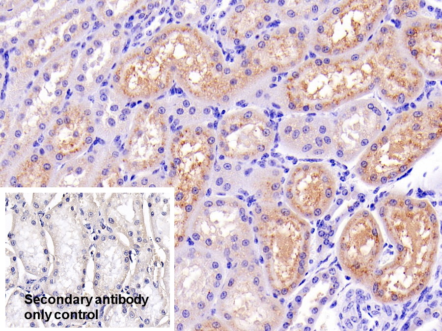 Polyclonal Antibody to Lysozyme (LZM)