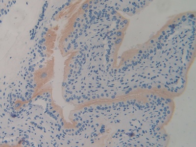 Polyclonal Antibody to Cartilage Oligomeric Matrix Protein (COMP)