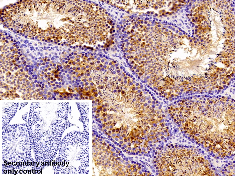 Polyclonal Antibody to Cartilage Oligomeric Matrix Protein (COMP)