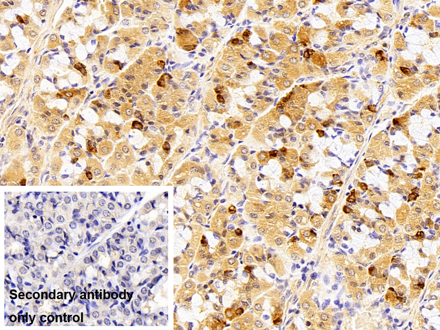 Polyclonal Antibody to Chromogranin A (CHGA)