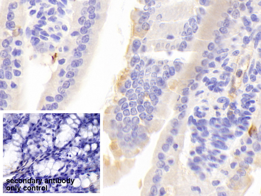 Polyclonal Antibody to Chromogranin A (CHGA)