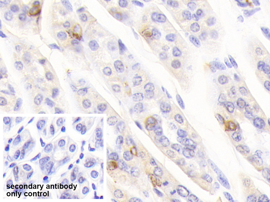 Polyclonal Antibody to Chromogranin A (CHGA)