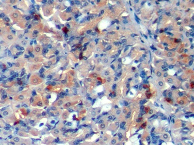 Polyclonal Antibody to Chromogranin A (CHGA)