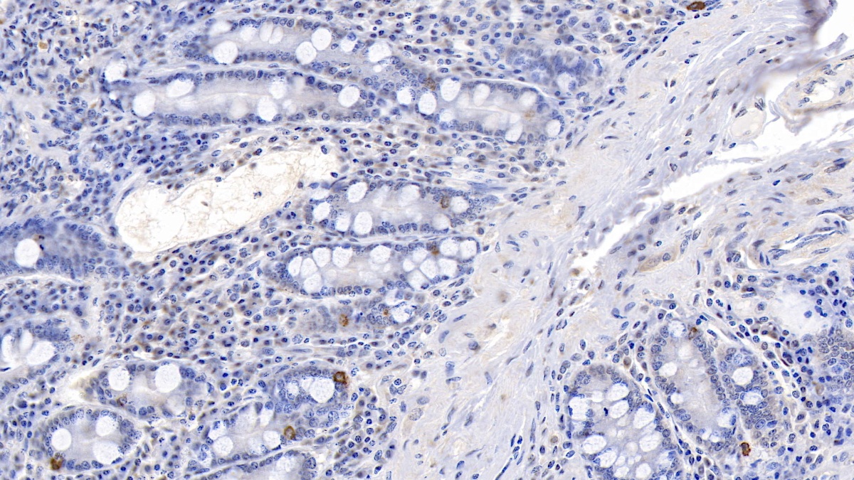 Polyclonal Antibody to Chromogranin A (CHGA)