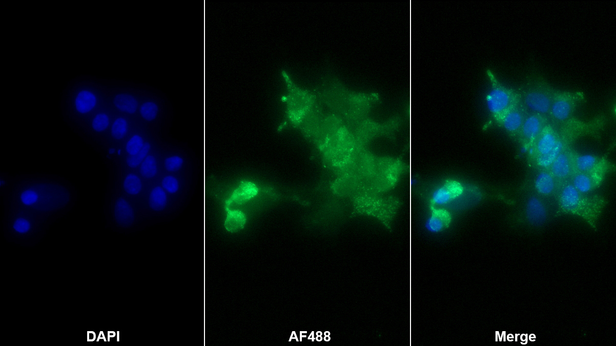 Polyclonal Antibody to Chromogranin A (CHGA)