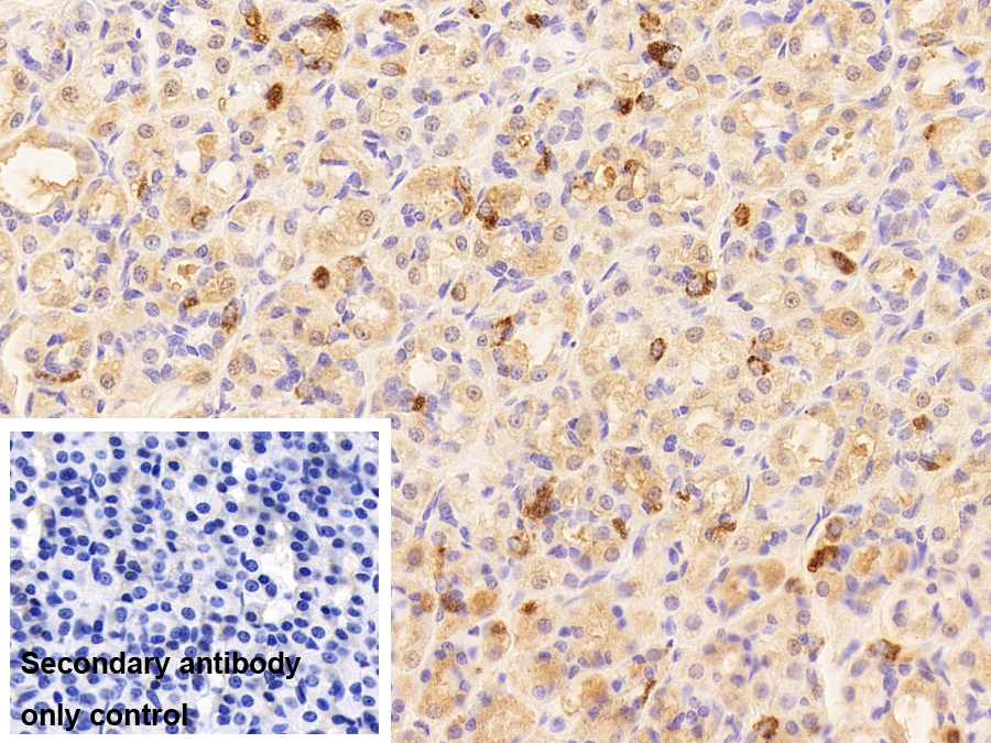 Polyclonal Antibody to Chromogranin A (CHGA)