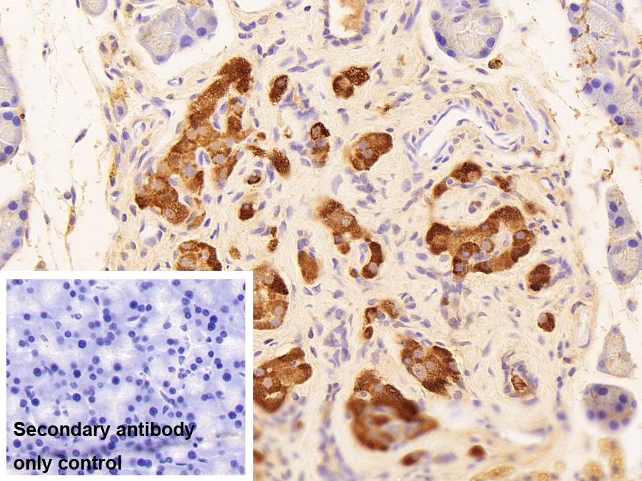 Polyclonal Antibody to Chromogranin A (CHGA)