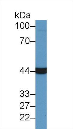 Polyclonal Antibody to Aspartate Aminotransferase (AST)