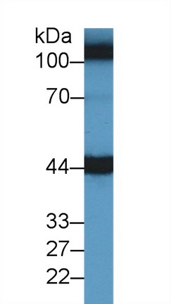 Polyclonal Antibody to Aspartate Aminotransferase (AST)