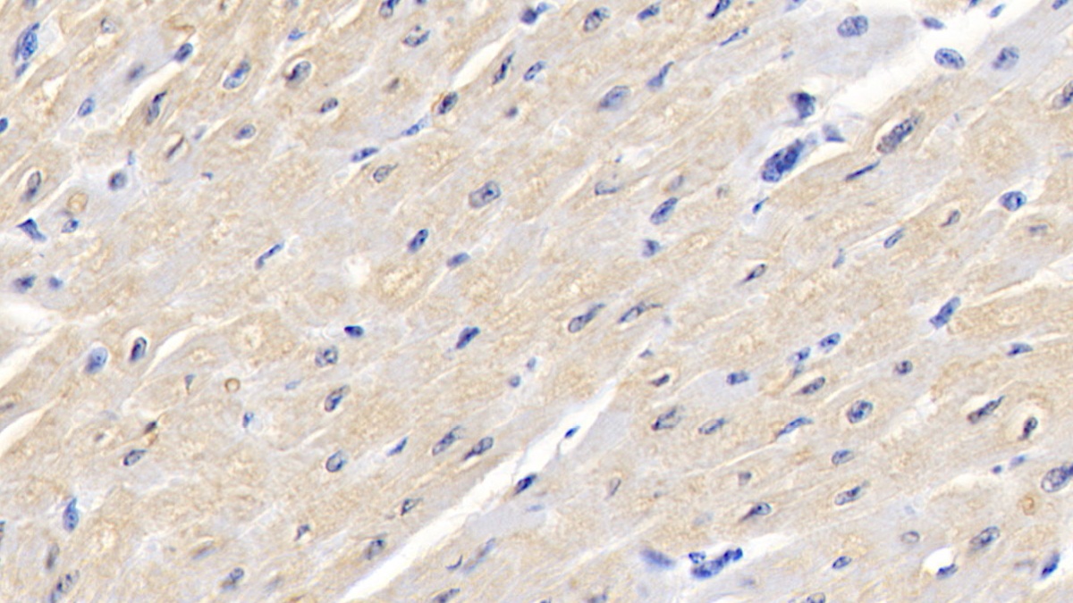 Polyclonal Antibody to Aspartate Aminotransferase (AST)