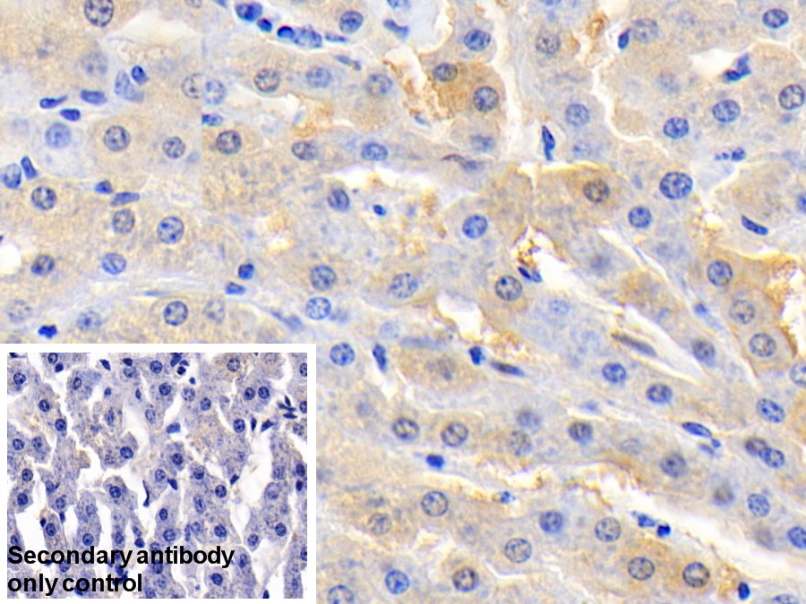 Polyclonal Antibody to Aspartate Aminotransferase (AST)