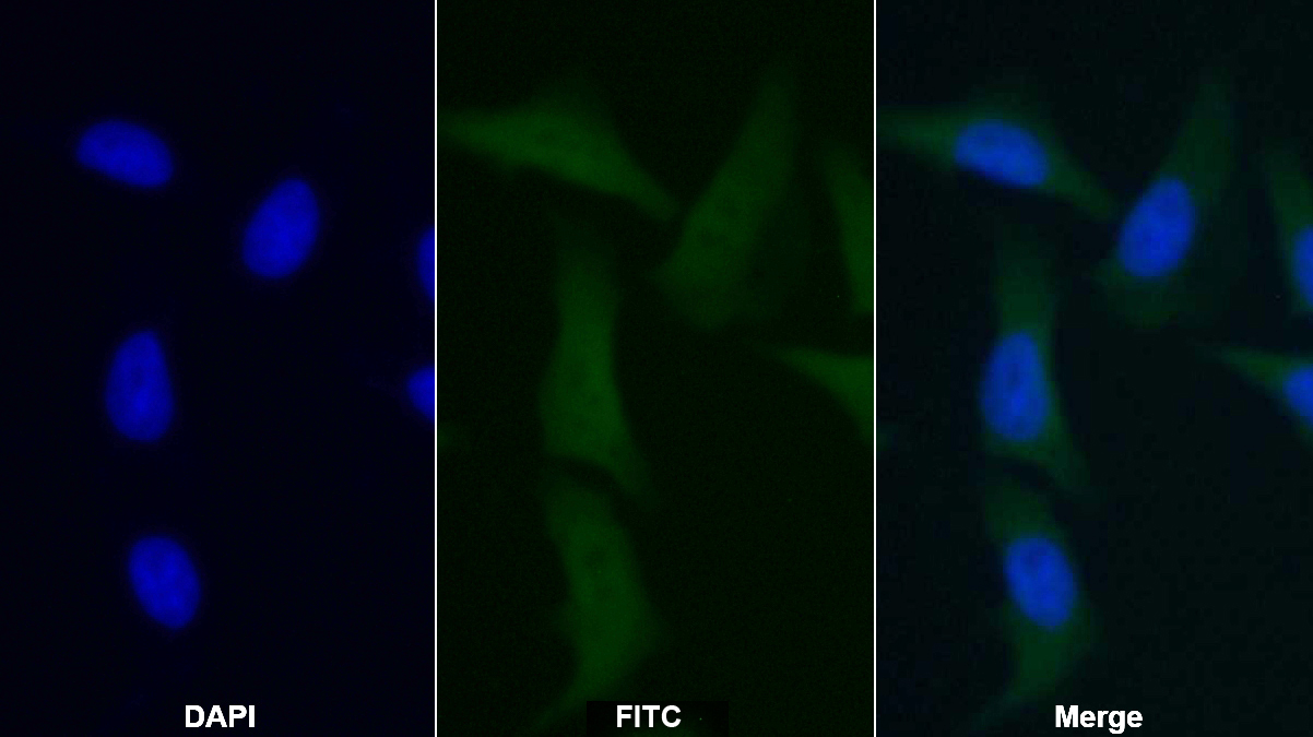Polyclonal Antibody to Aspartate Aminotransferase (AST)