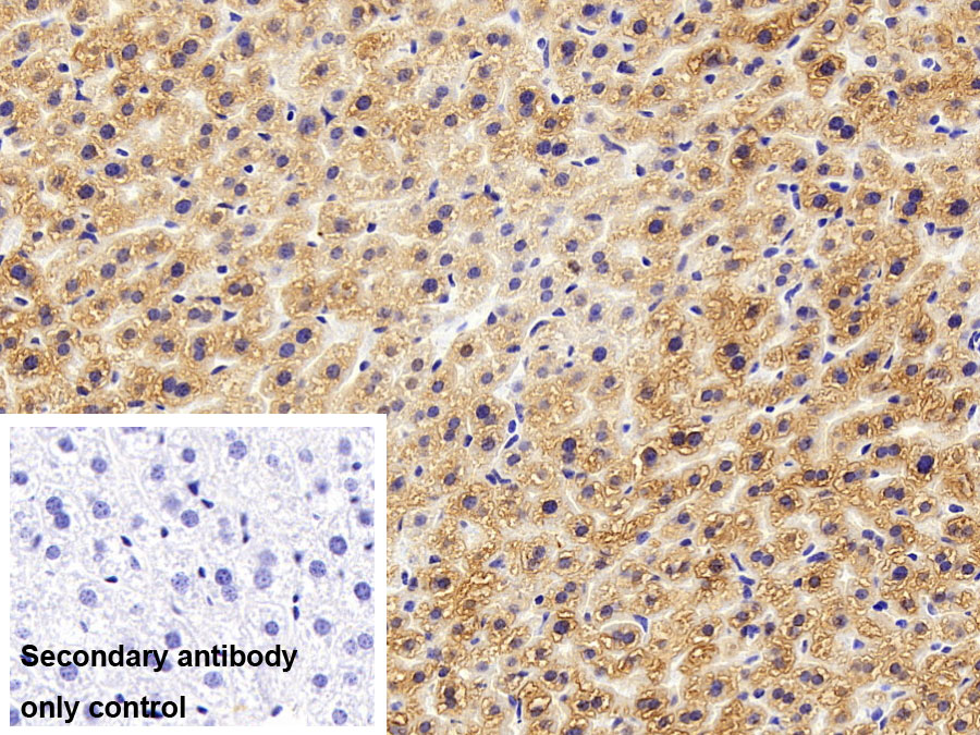 Polyclonal Antibody to Aspartate Aminotransferase (AST)