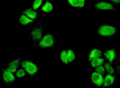 Polyclonal Antibody to Aspartate Aminotransferase (AST)