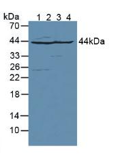 Polyclonal Antibody to Aspartate Aminotransferase (AST)