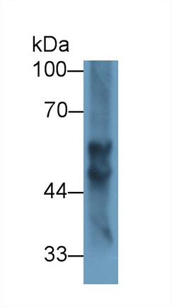 Polyclonal Antibody to Fibrinogen Beta Chain (FGB)