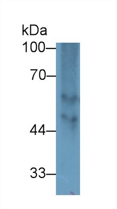 Polyclonal Antibody to Fibrinogen Beta Chain (FGB)