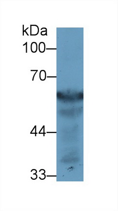 Polyclonal Antibody to Fibrinogen Beta Chain (FGB)