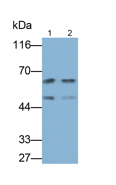 Polyclonal Antibody to Fibrinogen Beta Chain (FGB)