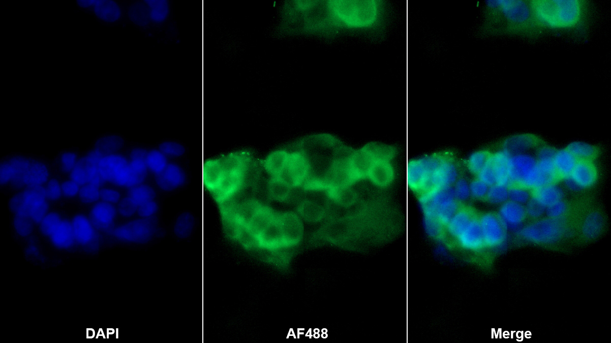 Polyclonal Antibody to Fibrinogen Beta Chain (FGB)