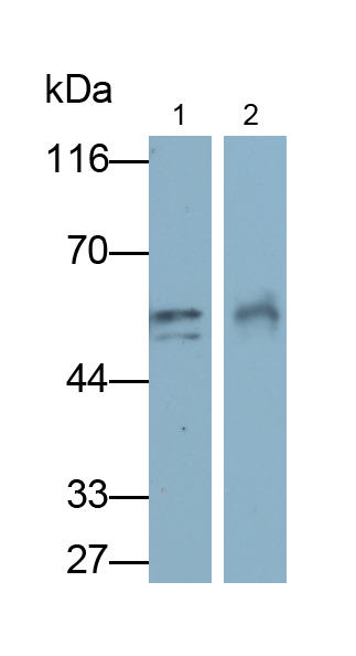 Polyclonal Antibody to Fibrinogen Beta Chain (FGB)