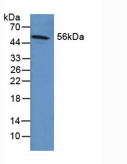 Polyclonal Antibody to Fibrinogen Beta Chain (FGB)