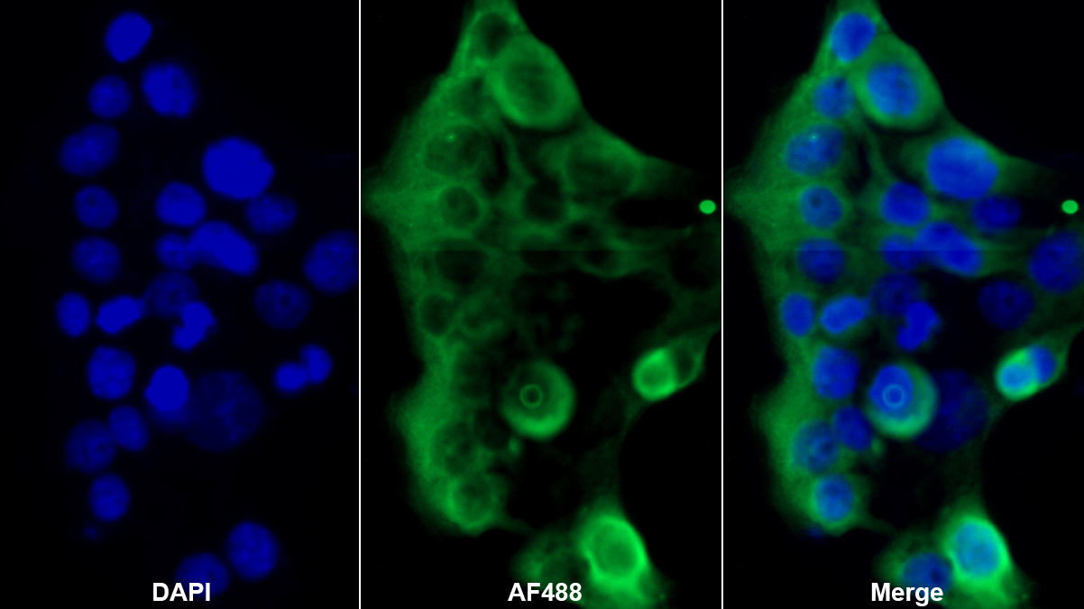 Polyclonal Antibody to Fibrinogen Beta Chain (FGB)
