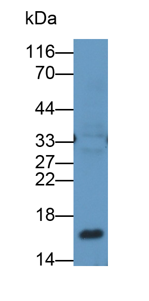 Polyclonal Antibody to Gastrin (GT)