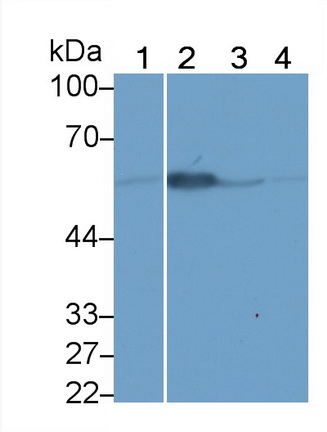 Polyclonal Antibody to Corticosteroid Binding Globulin (CBG)