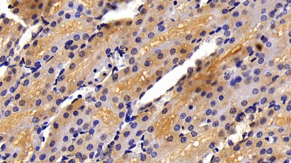 Polyclonal Antibody to Corticosteroid Binding Globulin (CBG)