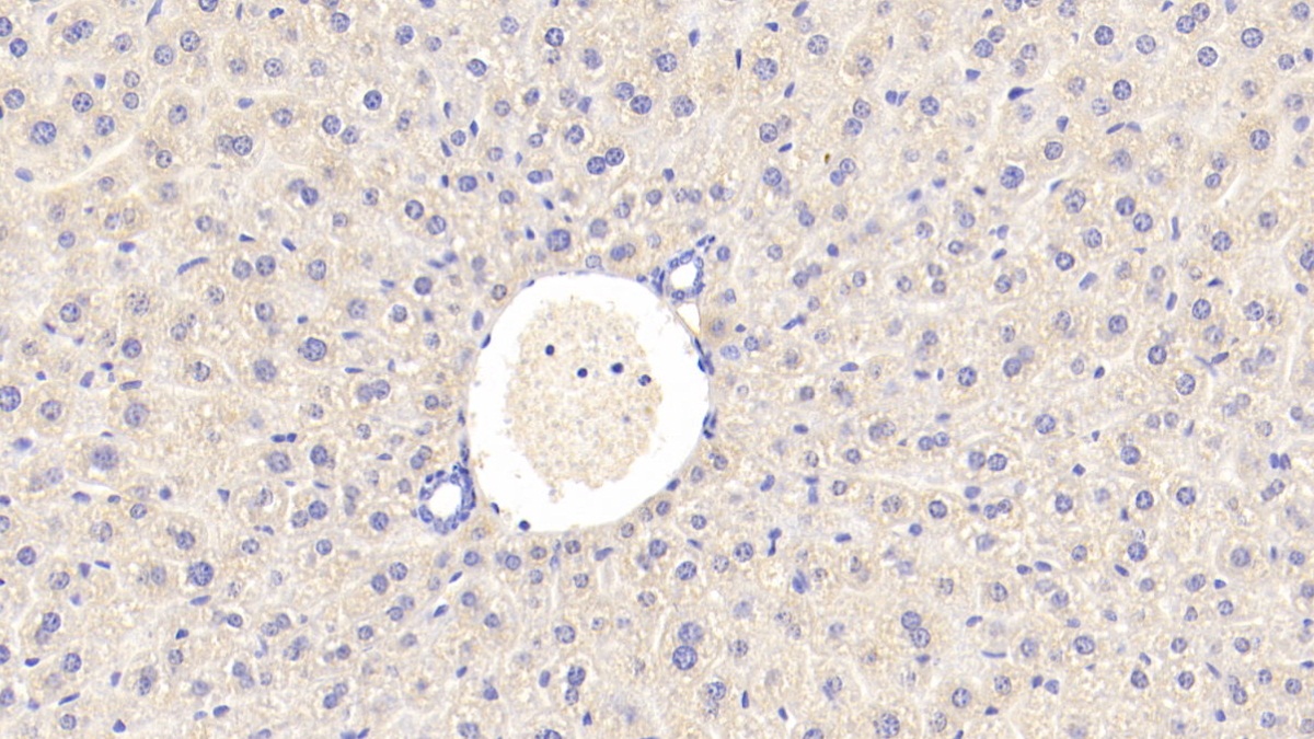 Polyclonal Antibody to Corticosteroid Binding Globulin (CBG)