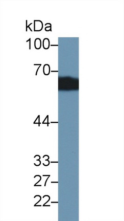 Polyclonal Antibody to Corticosteroid Binding Globulin (CBG)