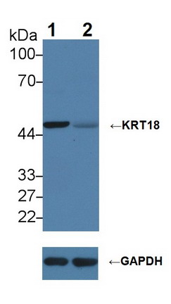 Polyclonal Antibody to Cytokeratin 18 (CK18)