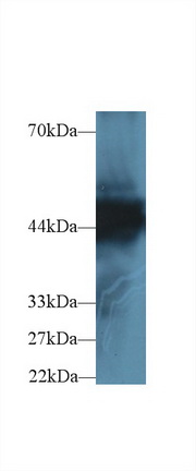 Polyclonal Antibody to Cytokeratin 18 (CK18)