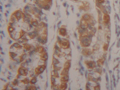 Polyclonal Antibody to Cytokeratin 18 (CK18)