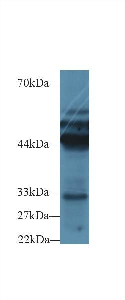 Polyclonal Antibody to Cytokeratin 18 (CK18)