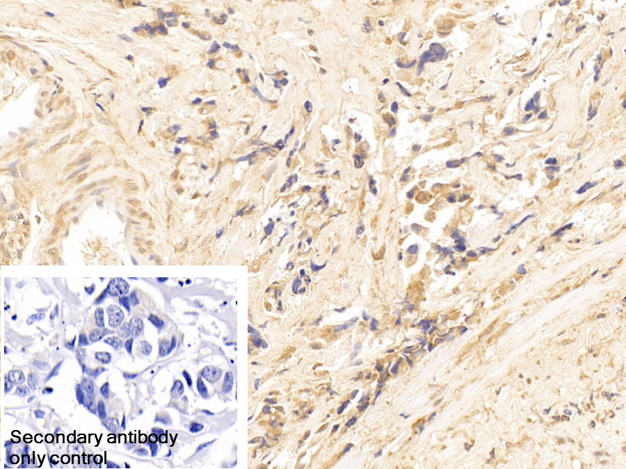 Polyclonal Antibody to Cytokeratin 18 (CK18)